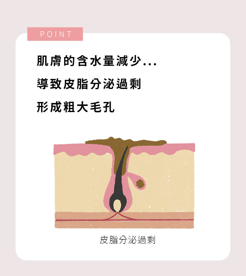 肌膚的含水量減少 皮脂分泌過剩 形成粗大毛孔